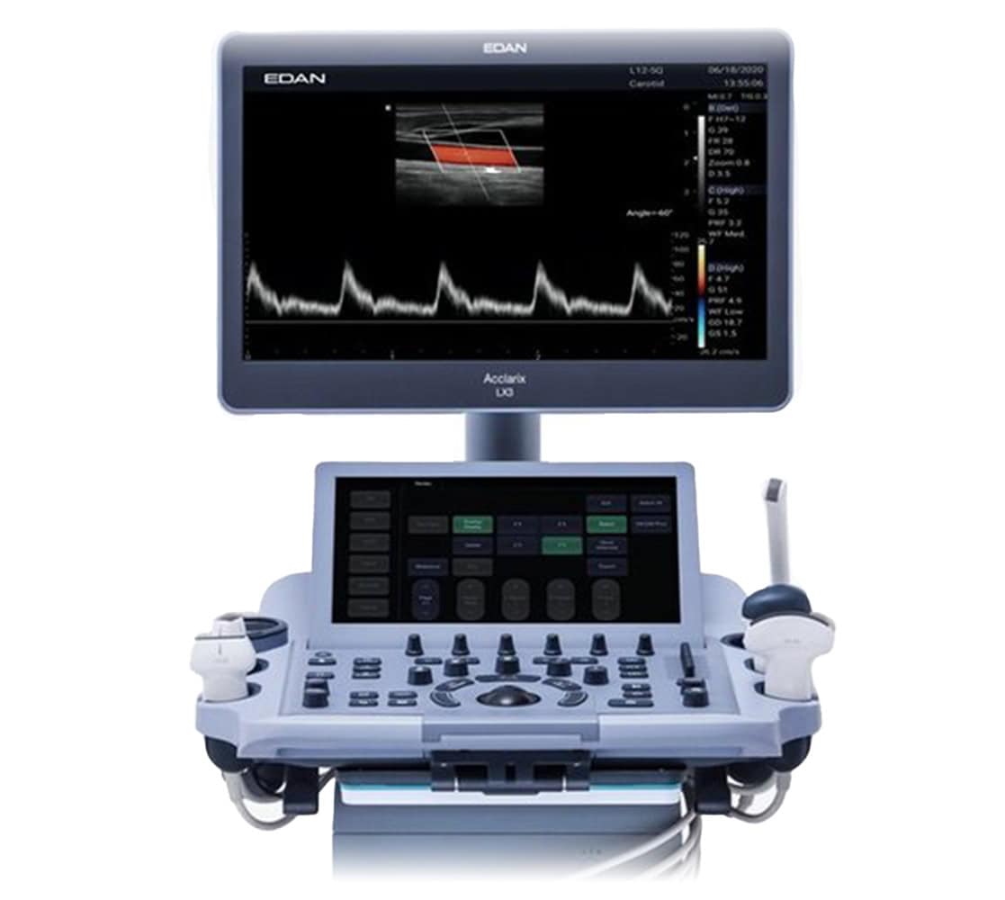 Edan Acclarix LX3 Ultraschallgerät