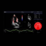Edan Acclarix LX9 Ultraschallgerät