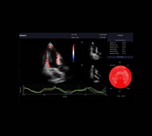 Edan Acclarix LX9 Ultraschallgerät