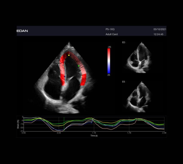 Edan Acclarix LX9 Ultraschallgerät