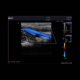 Edan Acclarix LX9 Ultraschallgerät
