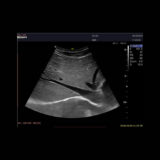 Edan Acclarix LX9 Ultraschallgerät