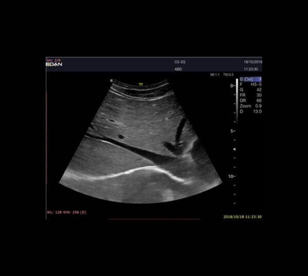 Edan Acclarix LX9 Ultraschallgerät