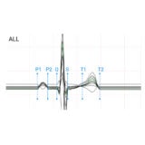 Edan PADEKG EKG-Gerät
