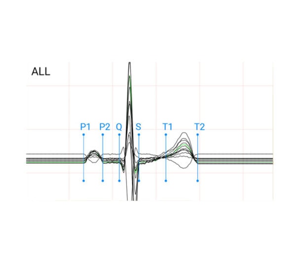 Edan PADEKG EKG-Gerät