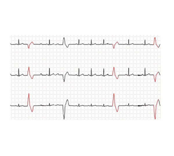 Edan PADEKG EKG-Gerät