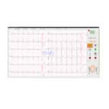 Edan SE-1515 EKG-Gerät