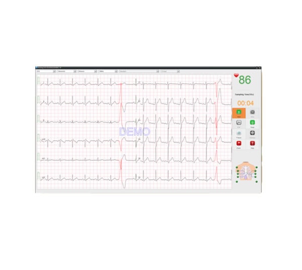 Edan SE-1515 EKG-Gerät