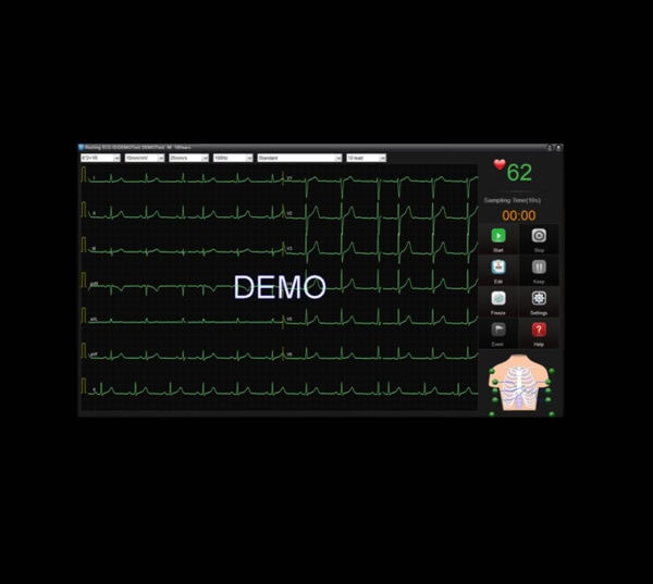 Edan SE-1515 EKG-Gerät