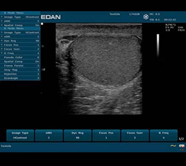 Edan U50 Ultraschallgerät