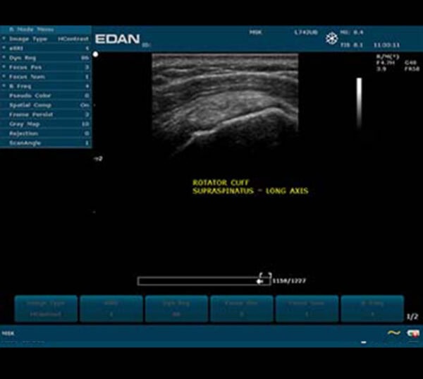 Edan U50 Ultraschallgerät