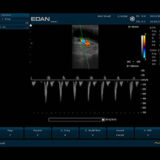 Edan U50 VET Ultraschallgerät