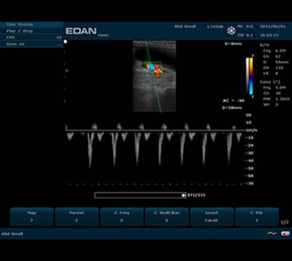 Edan U50 VET Ultraschallgerät