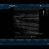 Edan U50 VET Ultraschallgerät