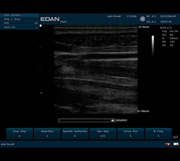 Edan U50 VET Ultraschallgerät