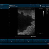 Edan U50 VET Ultraschallgerät