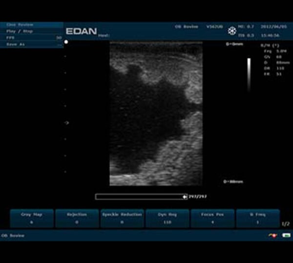 Edan U50 VET Ultraschallgerät