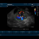 Edan U50 VET Ultraschallgerät