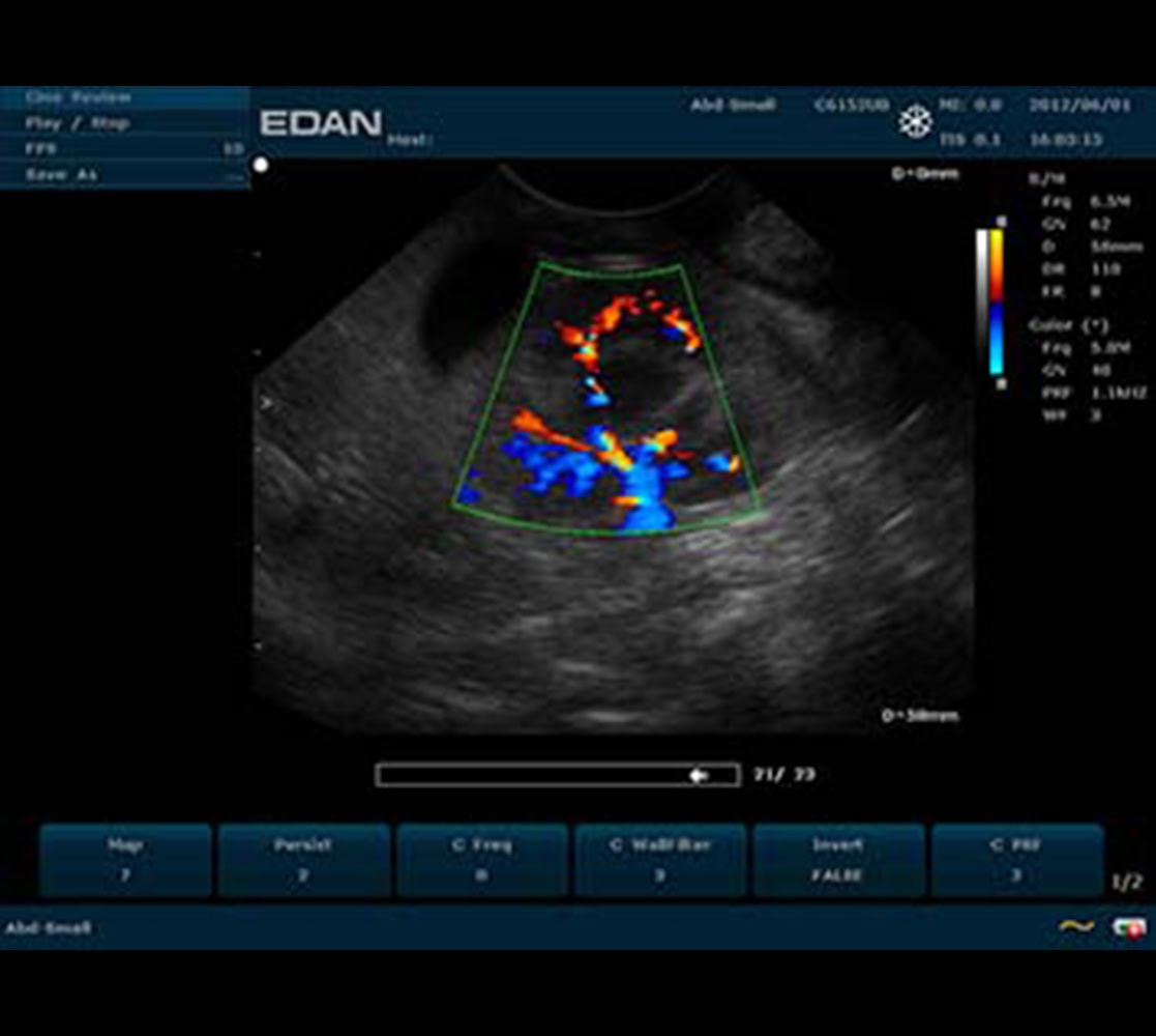 Edan U50 VET Ultraschallgerät