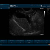 Edan U50 VET Ultraschallgerät