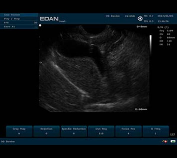 Edan U50 VET Ultraschallgerät
