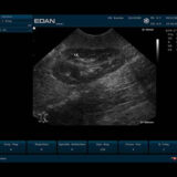 Edan U50 VET Ultraschallgerät