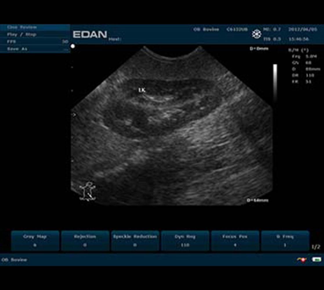 Edan U50 VET Ultraschallgerät