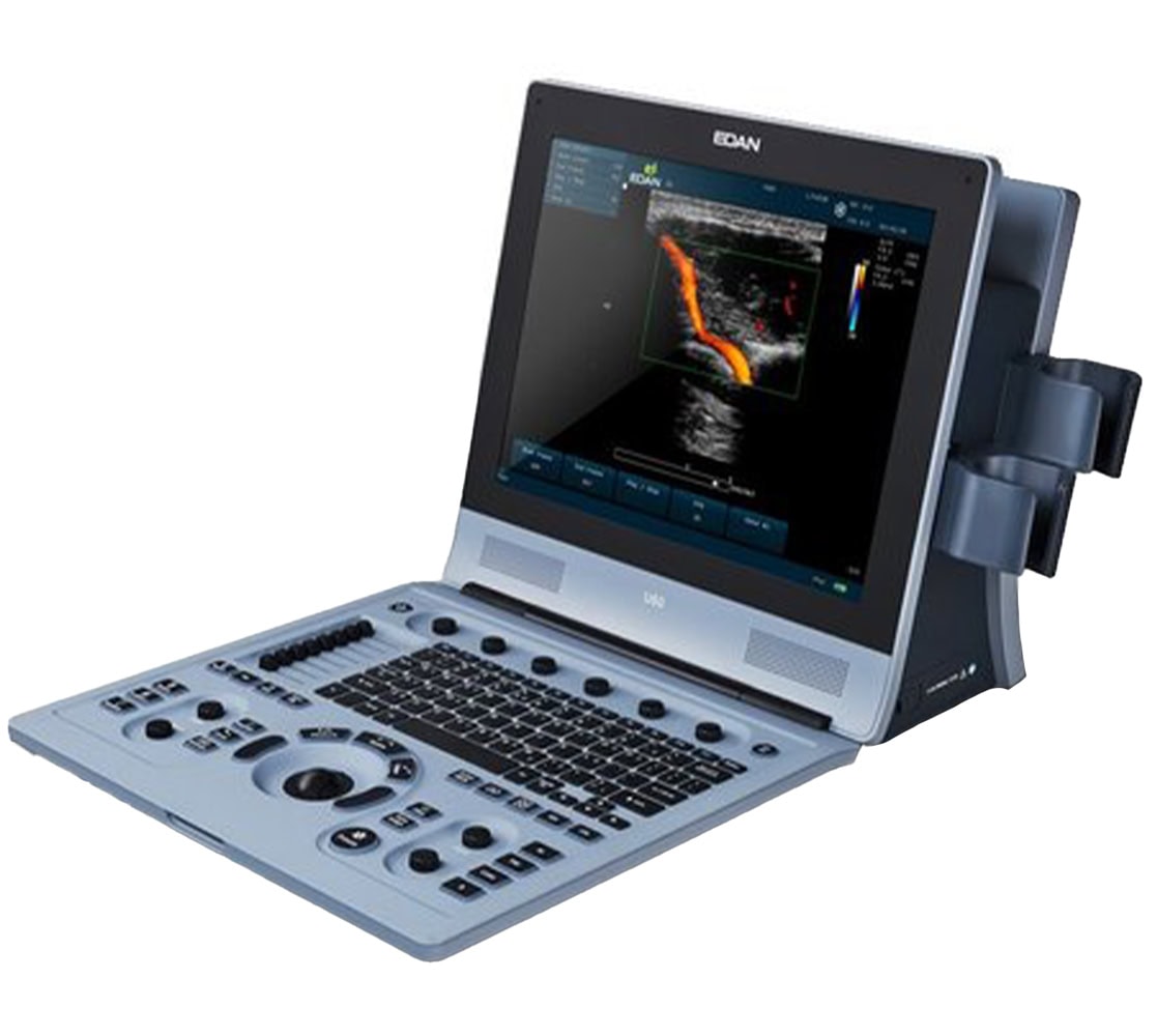 Edan U60 Ultraschallgerät