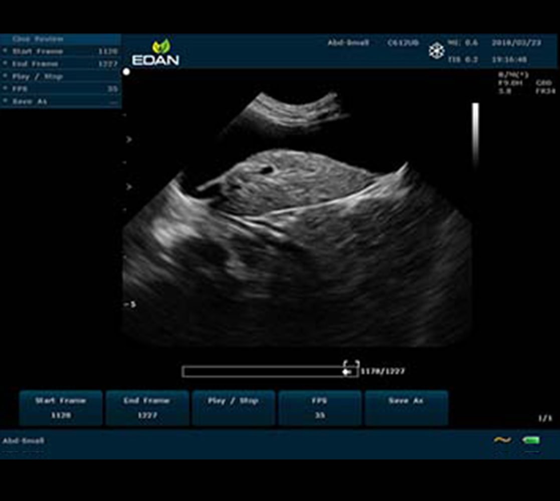 Edan U60 VET Ultraschallgerät