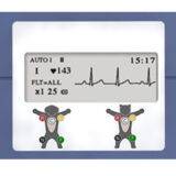 Edan VE-100 EKG-Gerät