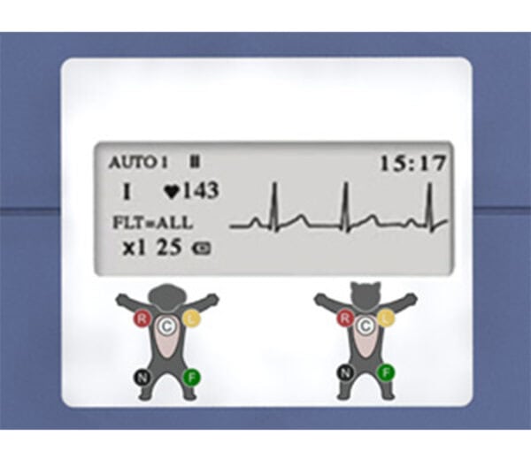 Edan VE-100 EKG-Gerät