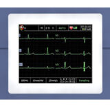 Edan VE-300 EKG-Gerät
