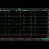 Mindray BeneHeart R700 EKG-Gerät