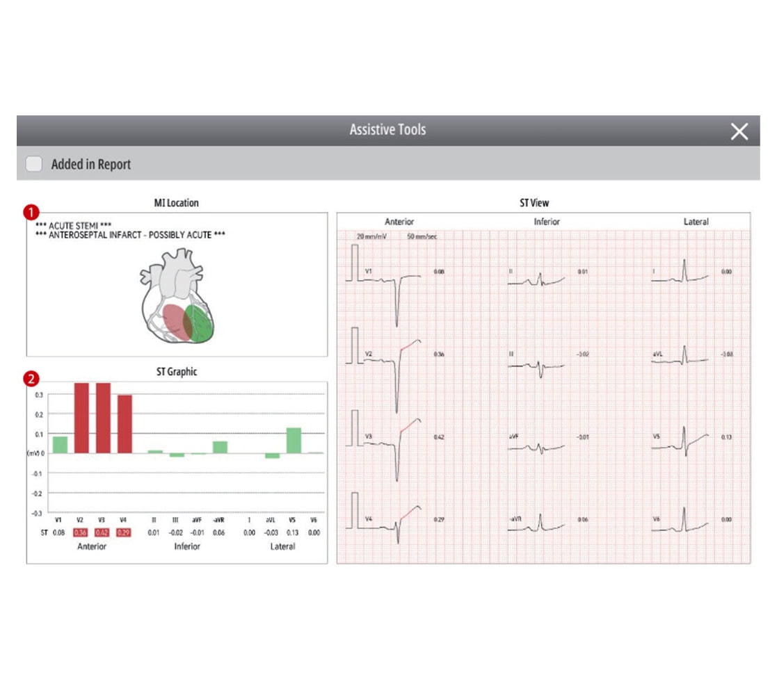 mindray-beneheart-r700-ekggeraete-2 Mindray BeneHeart R700 EKG-Gerät