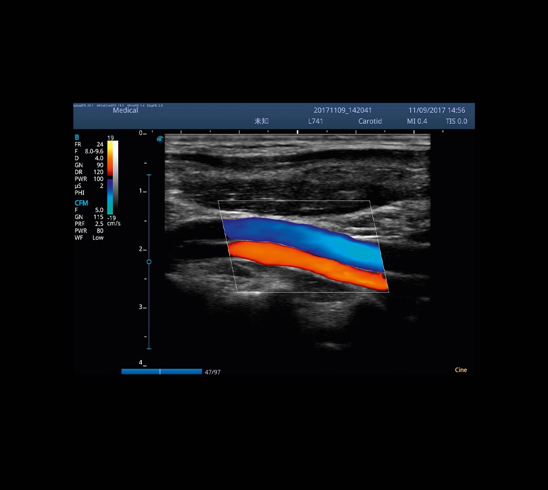 Zimmer SonidoSmart Pro Ultraschallgerät