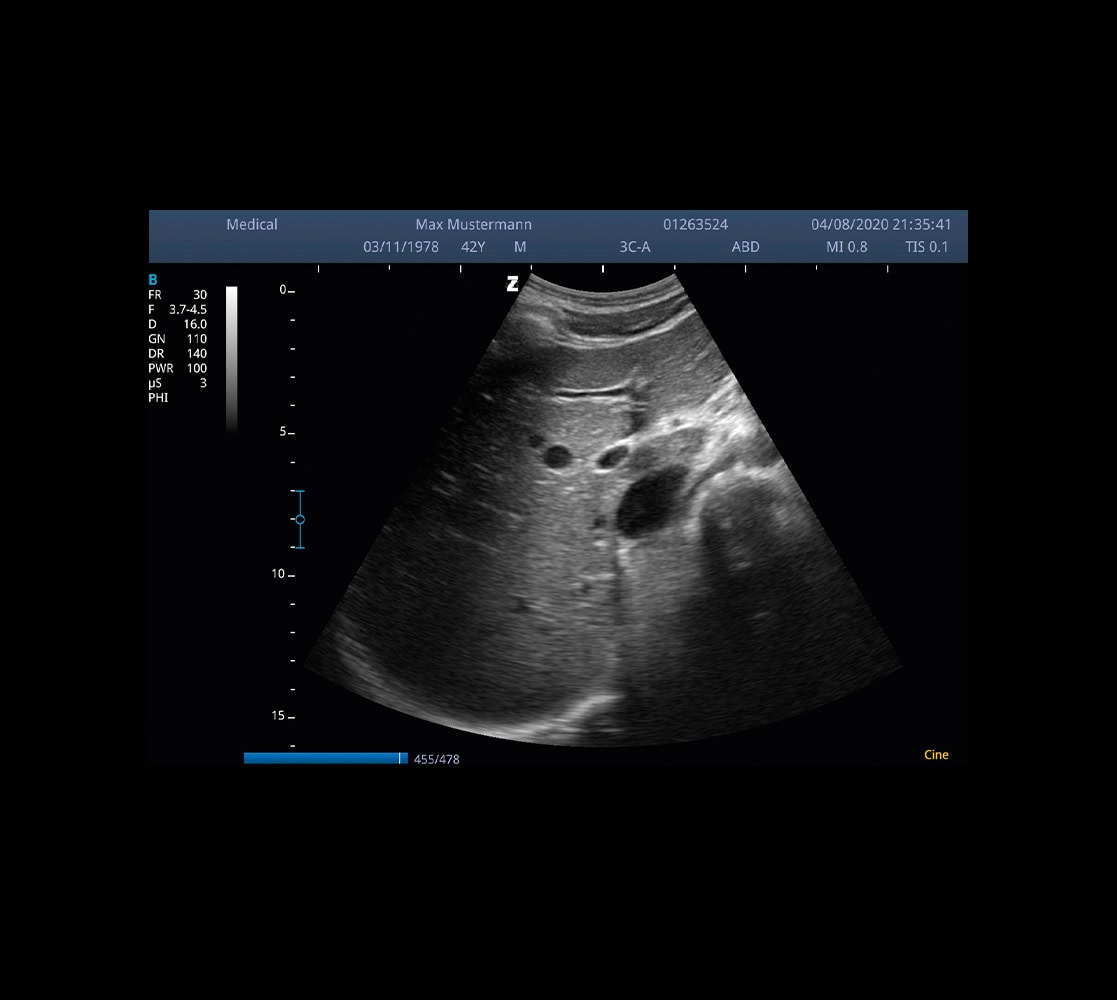 Zimmer SonidoSmart Pro Ultraschallgerät