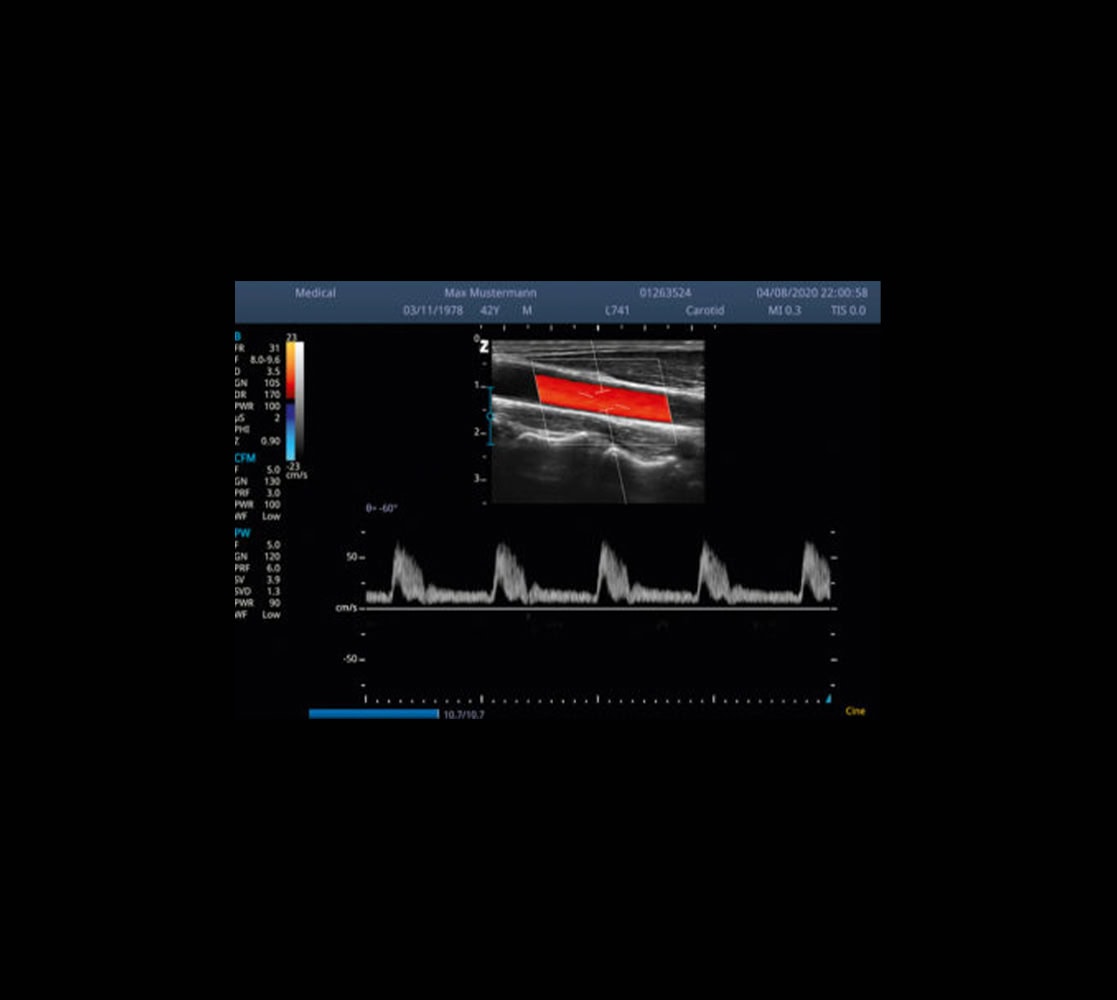 Zimmer SonidoSmart Pro Ultraschallgerät