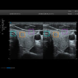 Zimmer SonoStage M1 Ultraschallgerät