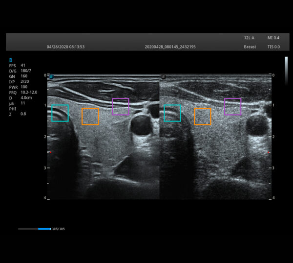 Zimmer SonoStage M1 Ultraschallgerät