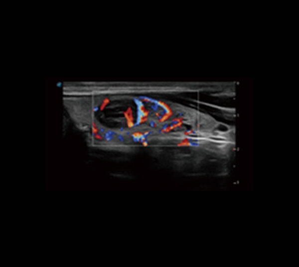 Zimmer SonoStage M1 Ultraschallgerät