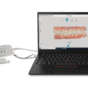 DEXIS IS 3700 Intraoralscanner mit Laptop