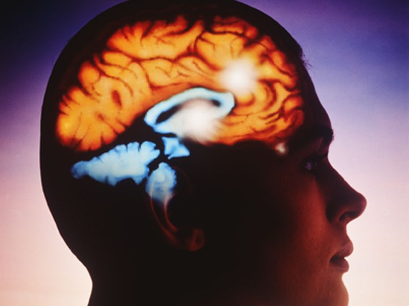 Models Predict Intracerebral Hemorrhage Growth