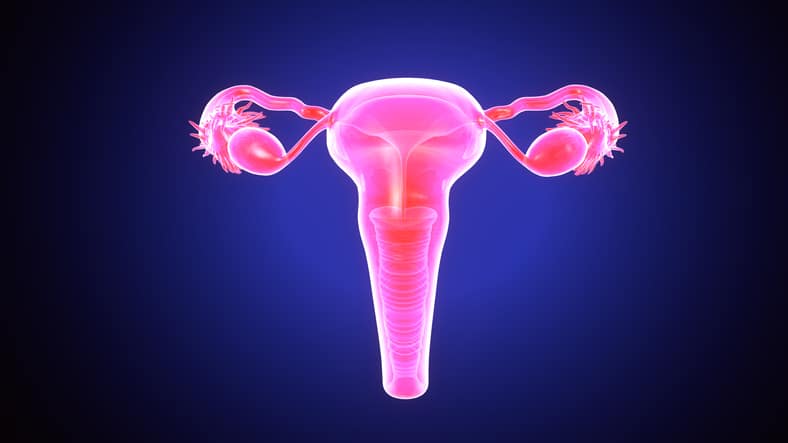 The EFFORT needed to overcome PARP resistance in ovarian cancer