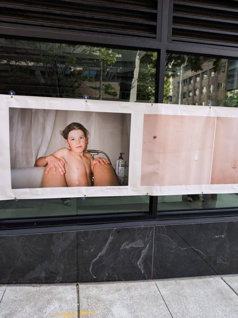 A photograph of a young child sitting in a bathtub is displayed in a window next to a close-up image of skin with a mole and a drop of water.