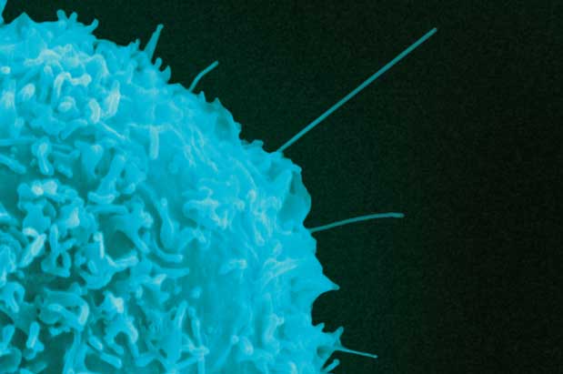 Immunotherapy Research is Rebooting Seattle's Biotech Sector