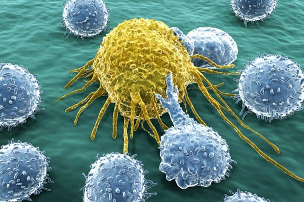 "Smart" Cancer Treatment for Kids