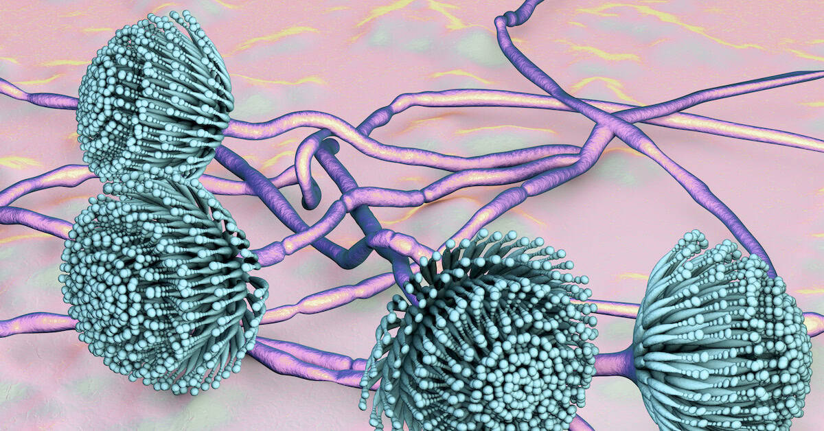 Can Mold Toxicity Cause Brain Cancer & Glioblastomas?