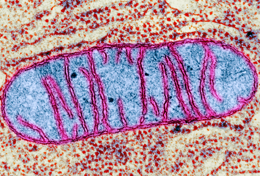 Mitochondrial dysfunction