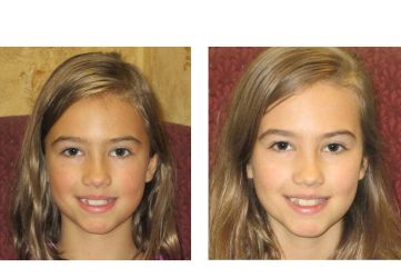 Ella from oregon lyme disease treatment
