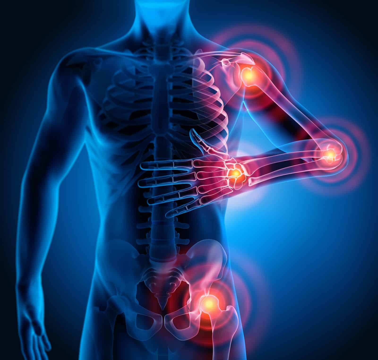 3d-rendering-severe-pain-in-the-joints-rheumatism-and-arthrosis